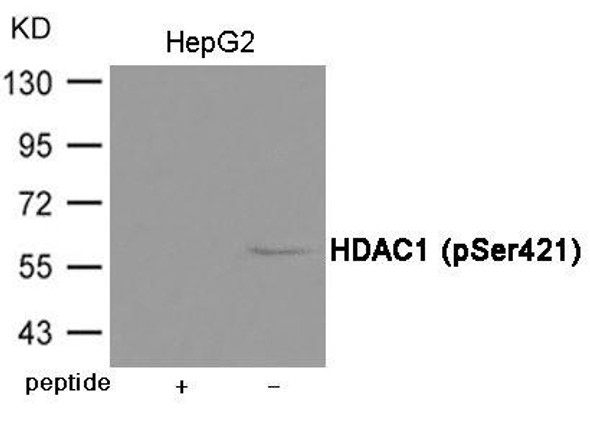 Phospho-HDAC1 (Ser421) Antibody (PACO23954)
