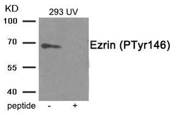 Phospho-EZR (Tyr146) Antibody (PACO24005)