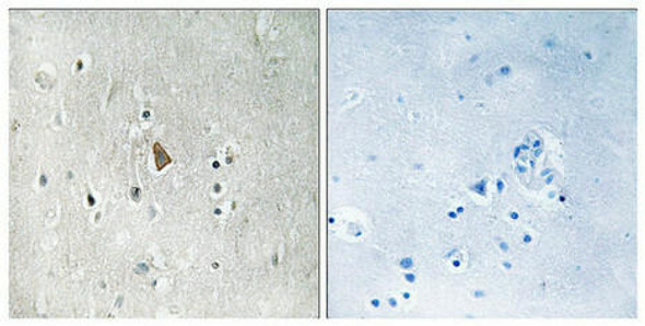 Phospho-IGF1R (Tyr1346) Antibody (PACO24103)