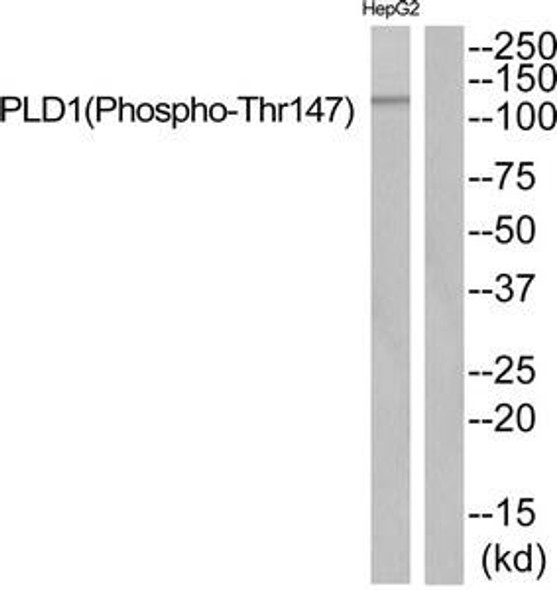 Phospho-PLD1 (Thr147) Antibody (PACO24162)