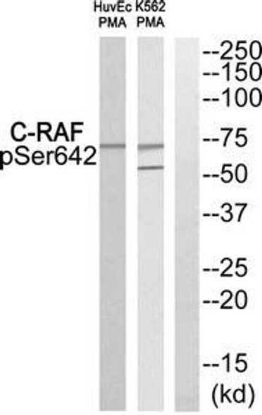 Phospho-RAF1 (Ser642) Antibody (PACO24169)