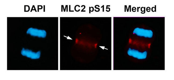 Phospho-MYL9 (Ser15) Antibody (PACO24214)