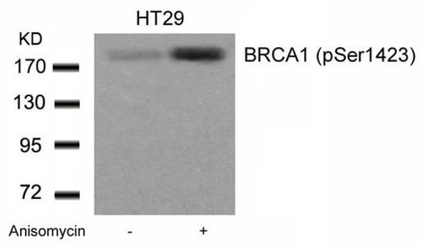 Phospho-BRCA1 (Ser1423) Antibody (PACO24311)