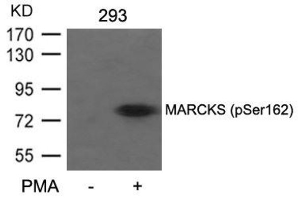 Phospho-MARCKS (Ser162) Antibody (PACO24316)