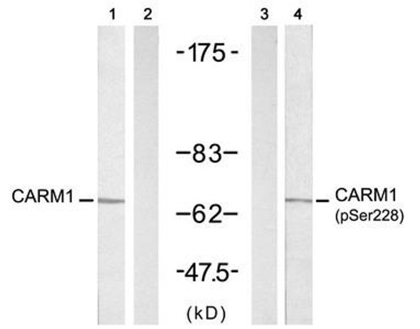 Phospho-CARM1 (Ser228) Antibody (PACO24363)