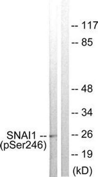 Phospho-SNAI1 (Ser246) Antibody (PACO24385)