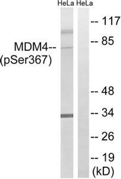 Phospho-MDM4 (Ser367) Antibody (PACO24429)