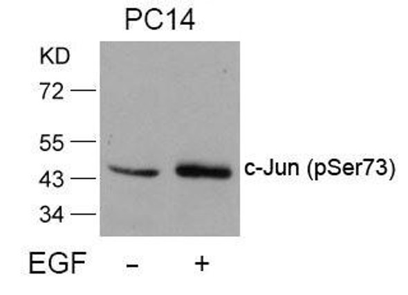 Phospho-JUN (Ser73) Antibody (PACO24439)