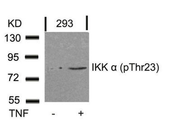 Phospho-CHUK (Thr23) Antibody (PACO24465)