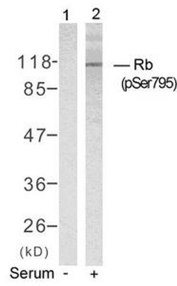 Phospho-RB1 (Ser795) Antibody (PACO24466)