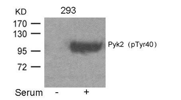 Phospho-PTK2B (Tyr402) Antibody (PACO24481)