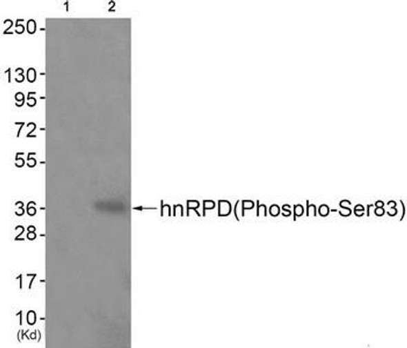 Phospho-HNRNPD (Ser83) Antibody (PACO24528)