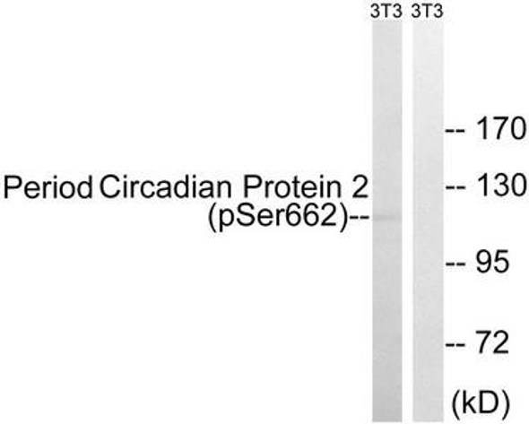 Phospho-PER2 (Ser662) Antibody (PACO24530)