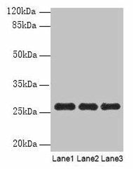 PEX11B Antibody (PACO28886)