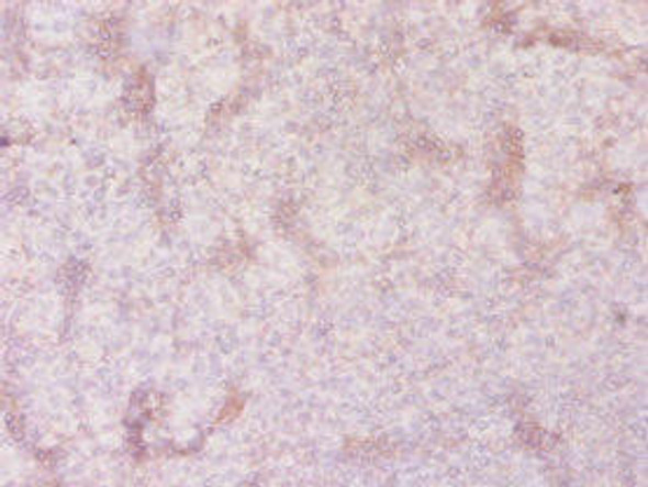 SLC41A2 Antibody (PACO29964)