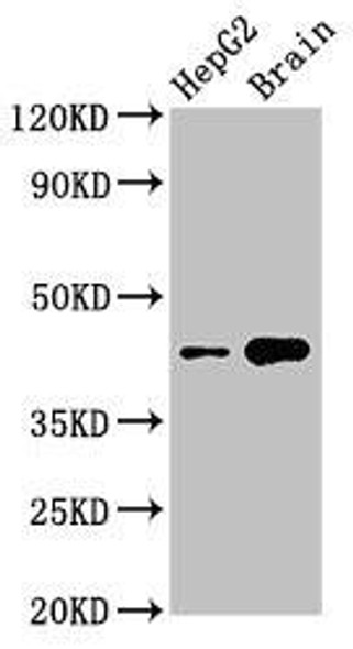 STK17B Antibody (PACO30178)