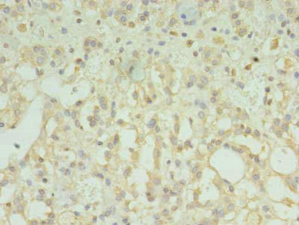 TMEM33 Antibody (PACO30586)