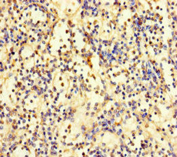 ZNF221 Antibody (PACO31208)