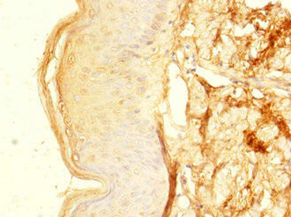 ZNF513 Antibody (PACO31348)