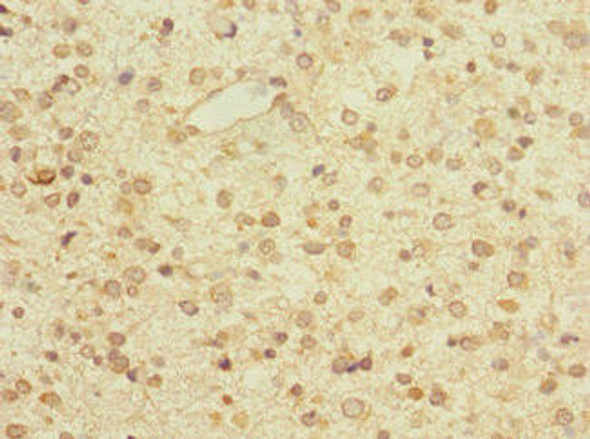 ZNF774 Antibody (PACO31496)