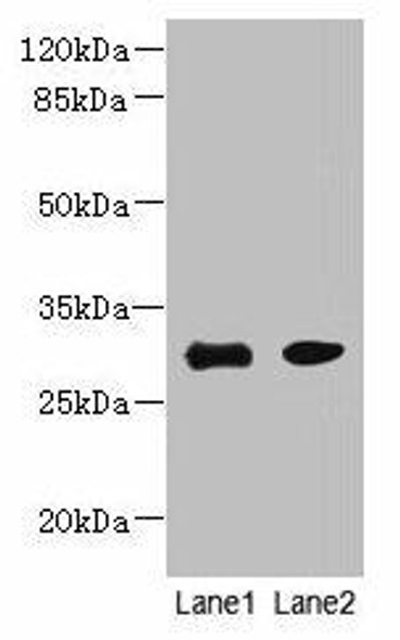 PI4KAP1 Antibody (PACO37958)