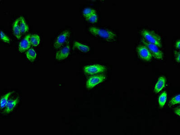 SPG11 Antibody (PACO38990)