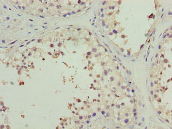 PPP1R14A Antibody (PACO39530)