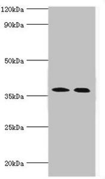 CA14 Antibody (PACO43694)