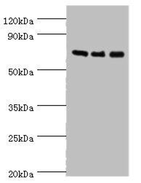 AKAP10 Antibody (PACO43805)