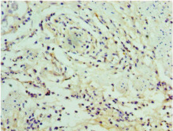 SERPINA12 Antibody (PACO43919)