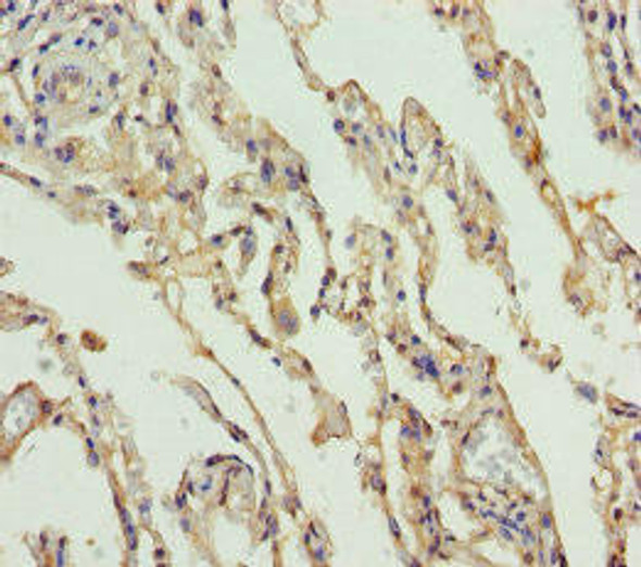 SLC34A1 Antibody (PACO44914)