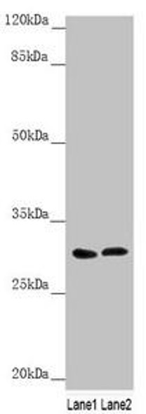 SNAP29 Antibody (PACO44978)