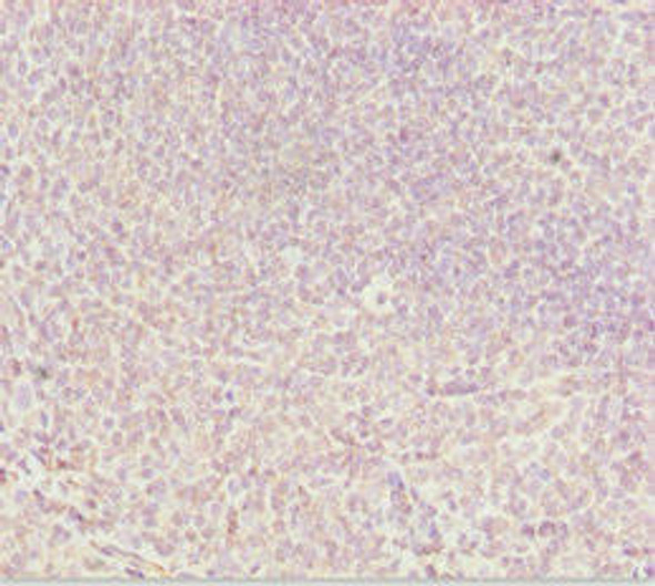 DDX11 Antibody (PACO44999)