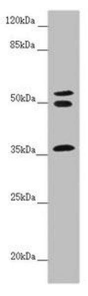 RNF41 Antibody (PACO45204)