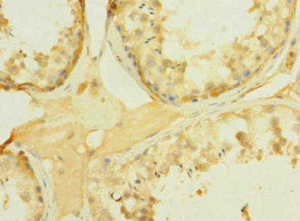 PCDH15 Antibody (PACO45463)