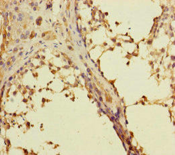 RAB27B Antibody (PACO45615)