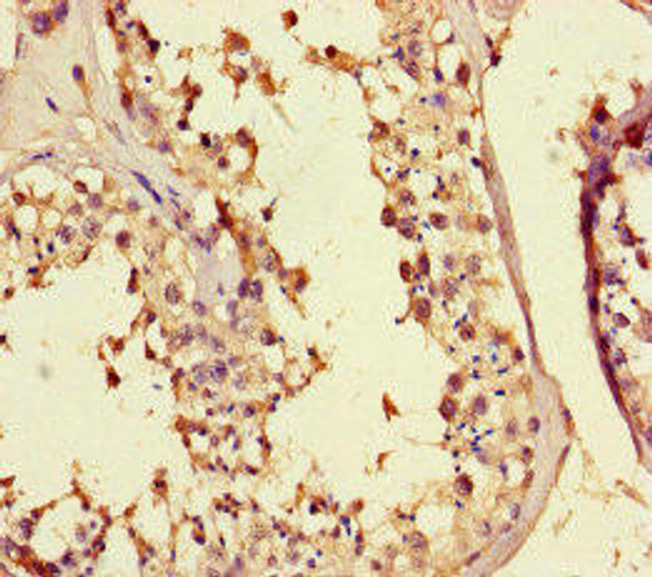 MED25 Antibody (PACO46650)