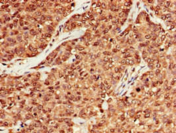 MRE11A Antibody (PACO51718)