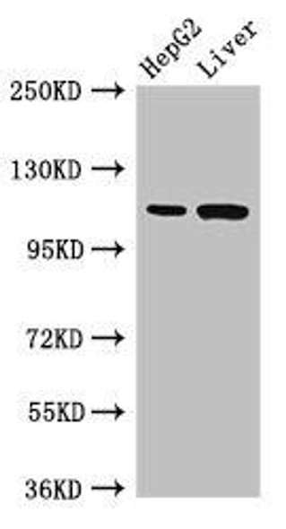 Tmprss15 Antibody (PACO51878)