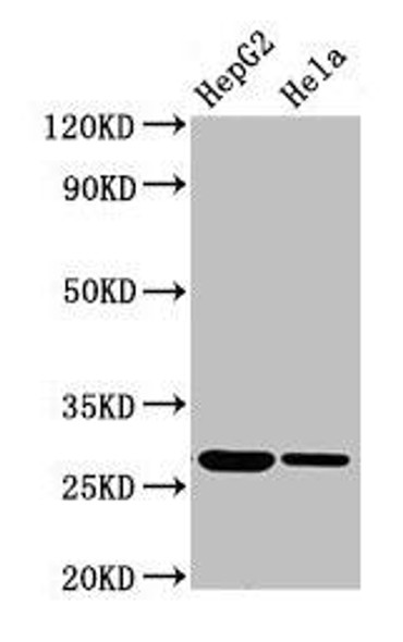 VPS29 Antibody (PACO52870)