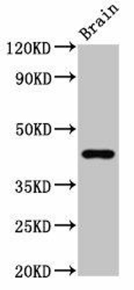 GPR143 Antibody (PACO55530)