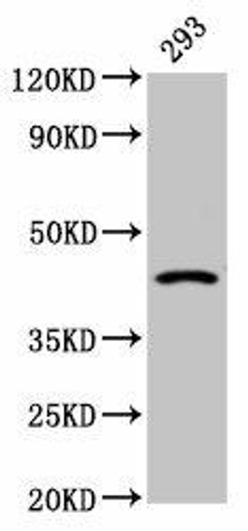 HSD11B2 Antibody (PACO55546)