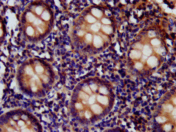CD99L2 Antibody (PACO57348)