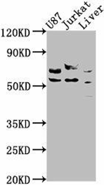 CDK5RAP3 Antibody (PACO63459)