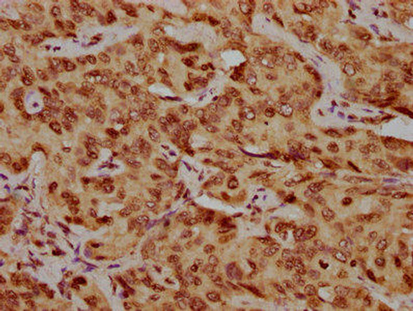 HIST1H1C (Ab-210) Antibody (PACO60626)