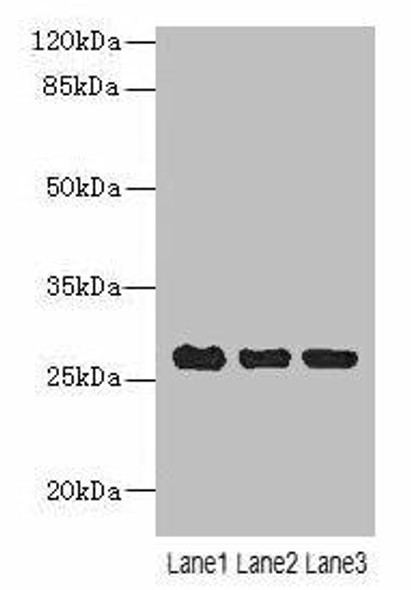 C10orf82 Antibody (PACO38638)