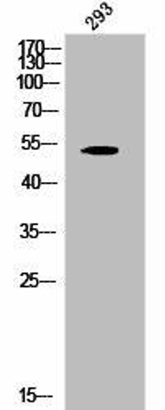 Phospho-KRT8 (S432) Antibody (PACO02856)