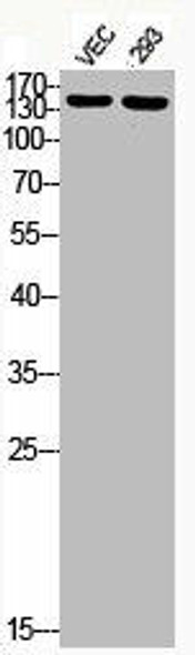 Phospho-IRS1 (S307) Antibody (PACO06133)