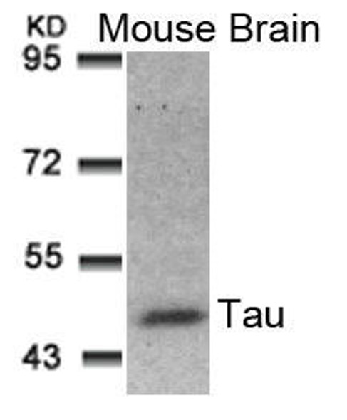 MAPT (Ab-181) Antibody (PACO21367)