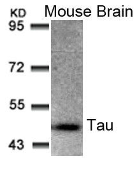 MAPT (Ab-205) Antibody (PACO21368)